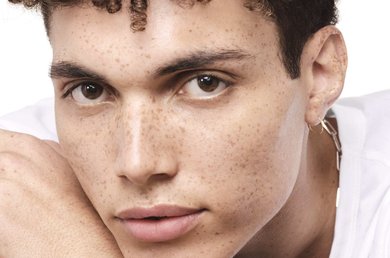 winter-acne-how-to-manage-imperfection-prone-dry-skin