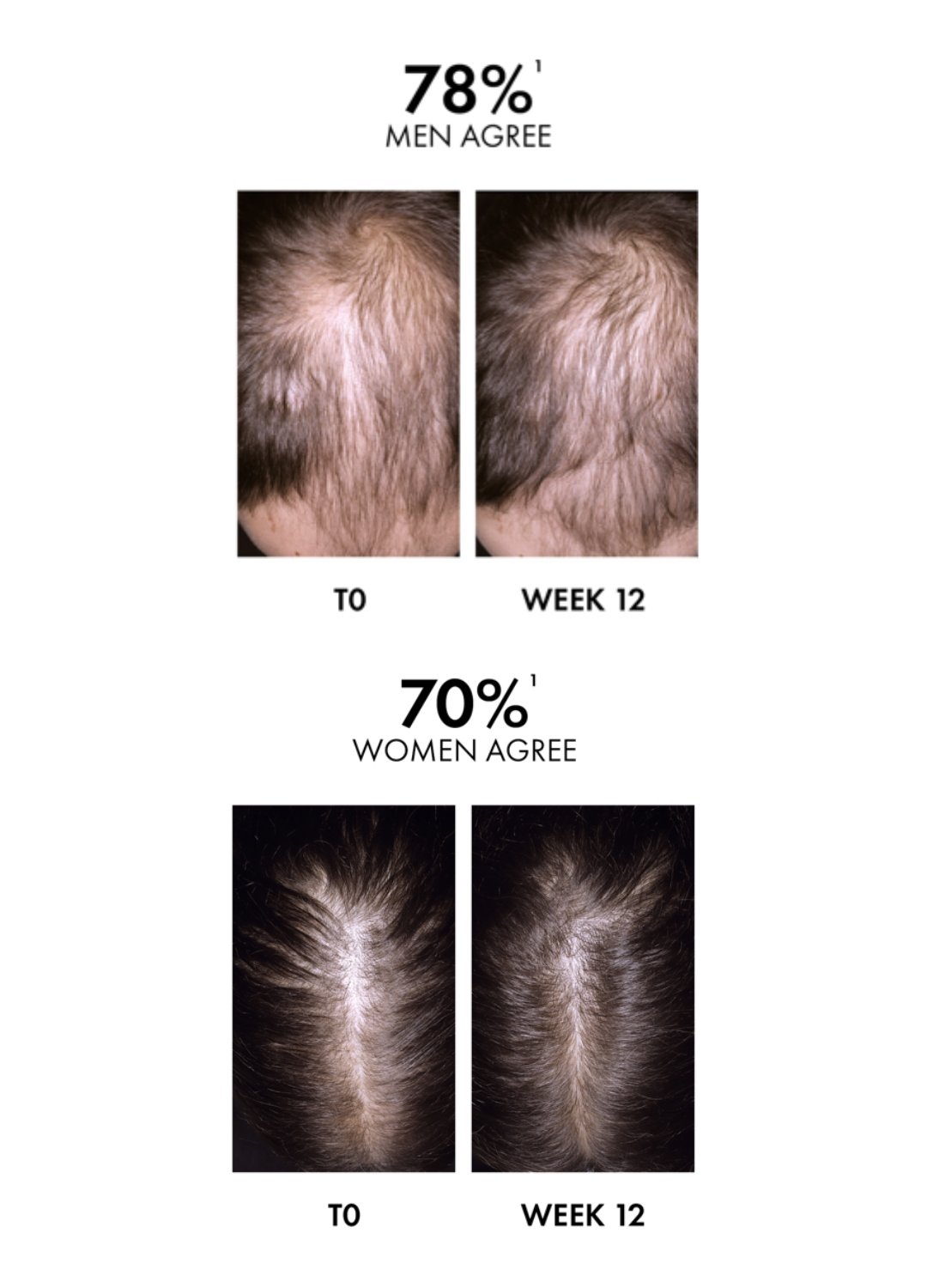 Vichy-Website-PDP-Regen-3337875896443-Content-block-Before-After-mobile